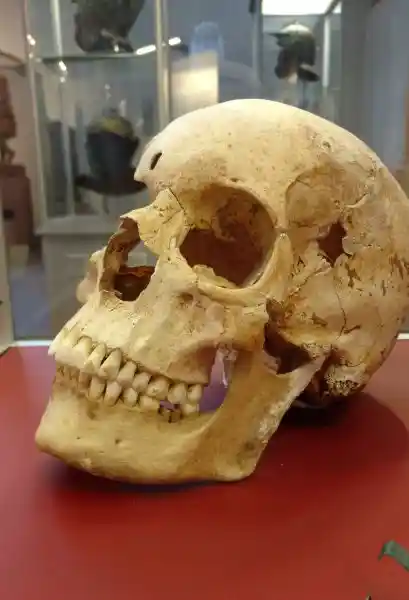 Skull from the 3rd Century